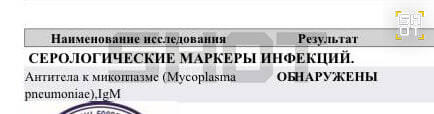 Исследователи выяснили, что за новый вирус начал распространяться в России uditeiuxidukmp